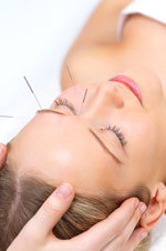 DuPage Acupuncture